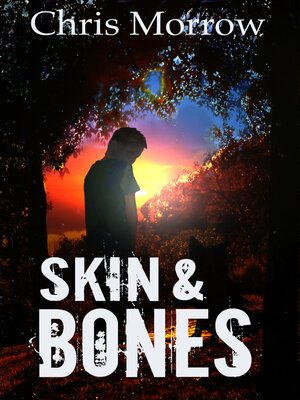 cover image of Skin & Bones